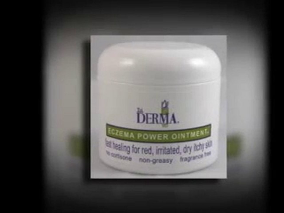 Eczema Creams for Your Eczema Rash