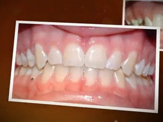 Greeley orthodontist