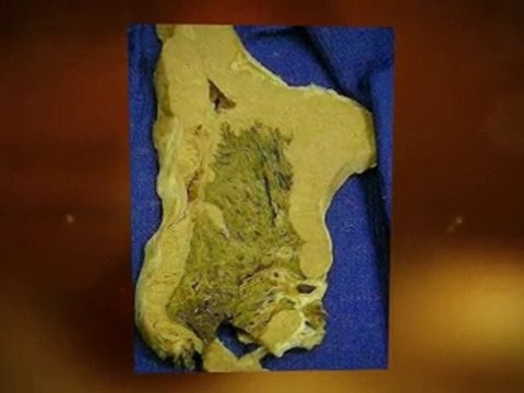 Asbestos Mold Problem Bradenton FL