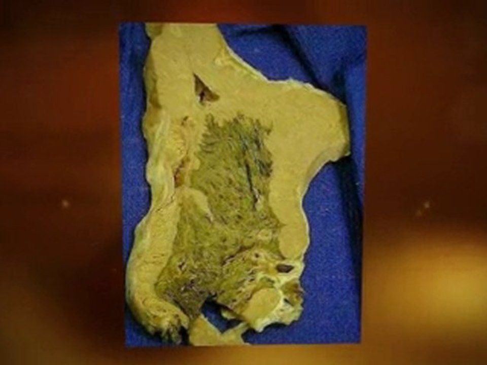 Asbestos Mold Problem Daytona Beach FL