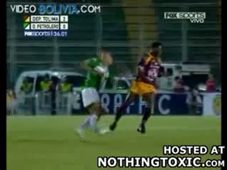 Un footballeur se casse une jambe