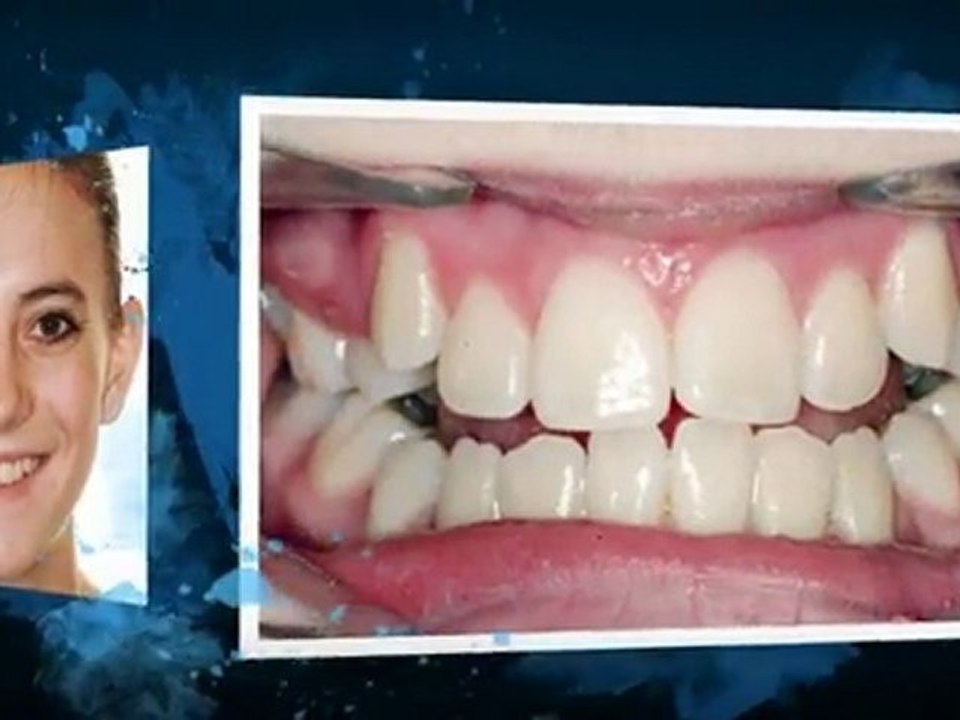 Westminster CO Orthodontist great new smiles