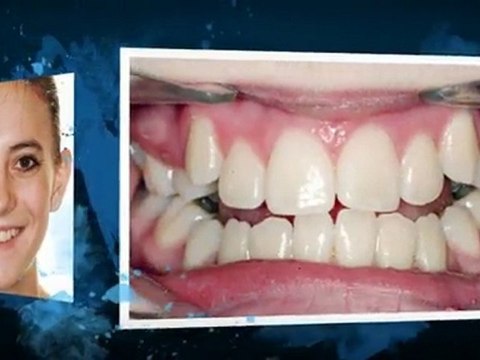 Westminster CO Orthodontist great new smiles