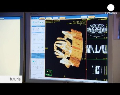 Un coeur virtuel pour améliorer les traitements des...