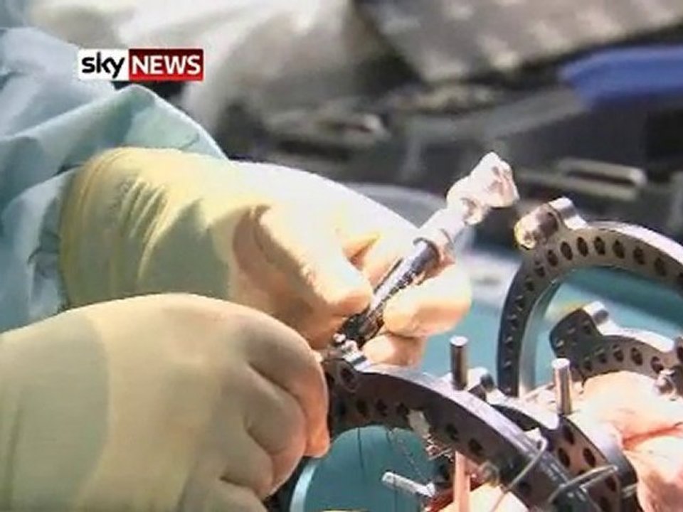Stem Cells - Shattered Leg Rebuilt Using New Technique