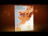 Nail Fungus Treatments and Cures