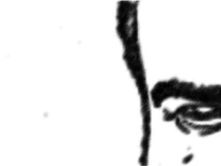 R-MYTHE (Jean Jean) "Le cancer du colon"