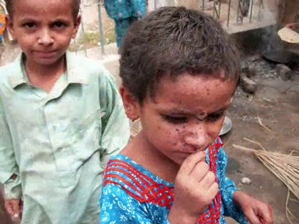 UMKE Pakistan da
