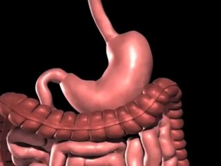 Lap band Surgery Austin