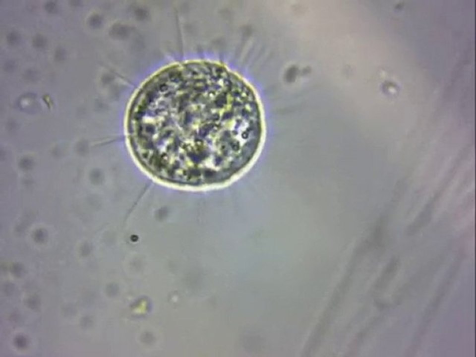 Un héliozoaire : l'actinosphaerium