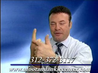 Hammertoes - Chicago Podiatrist