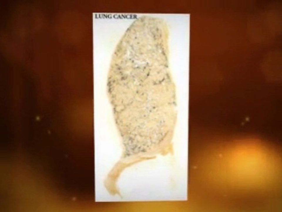 Asbestos Exposure Pomona CA