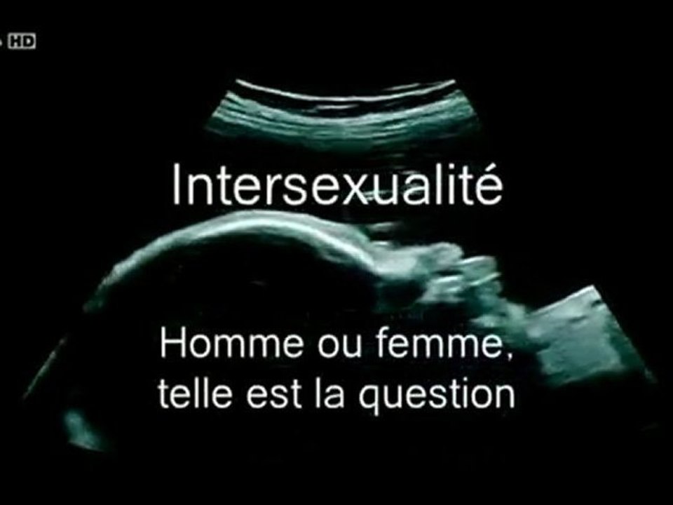 Intersexualité - homme ou femme, telle est la question - 1_3