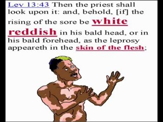 Who Esau is Lining Up with Prophecy pt1