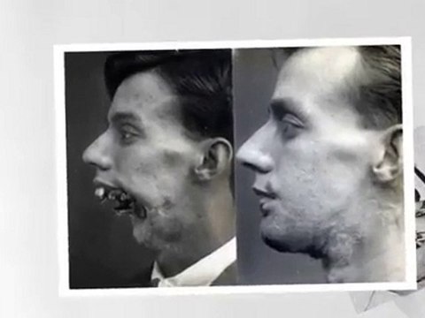 Atrocités de guerre avant que Pierre Sellier claironne