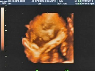 Ultrasound Rancho Cucamonga | Ultrasound 3D 4D