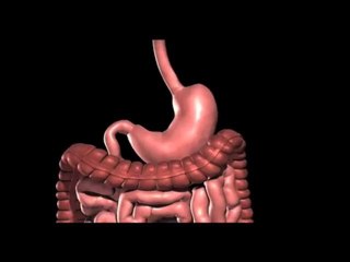 Lap band Surgery Austin