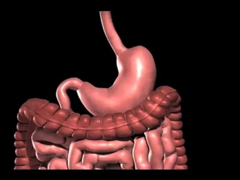 Lap band Surgery Austin