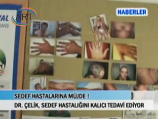 Dr. Recep Çelik Sedef Hastalığı Haberi