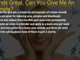 Home Remedies For Acne - Secrets The Pharmacies Hide -Part 1