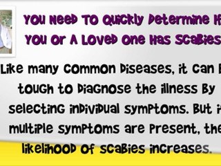 Download Video: Scabies Home Remedies - Treatment Of Scabies - Scabies Medic