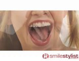 Teeth Whitening - Get a Celebrity Smile