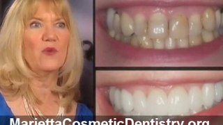 Marietta Cosmetic Dentistry