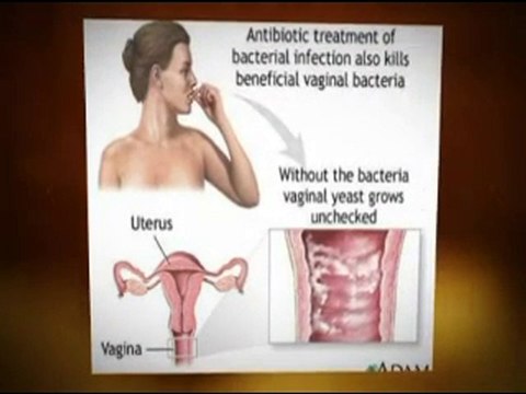 Yeast Infection In Men -Symptoms, Causes and Cures