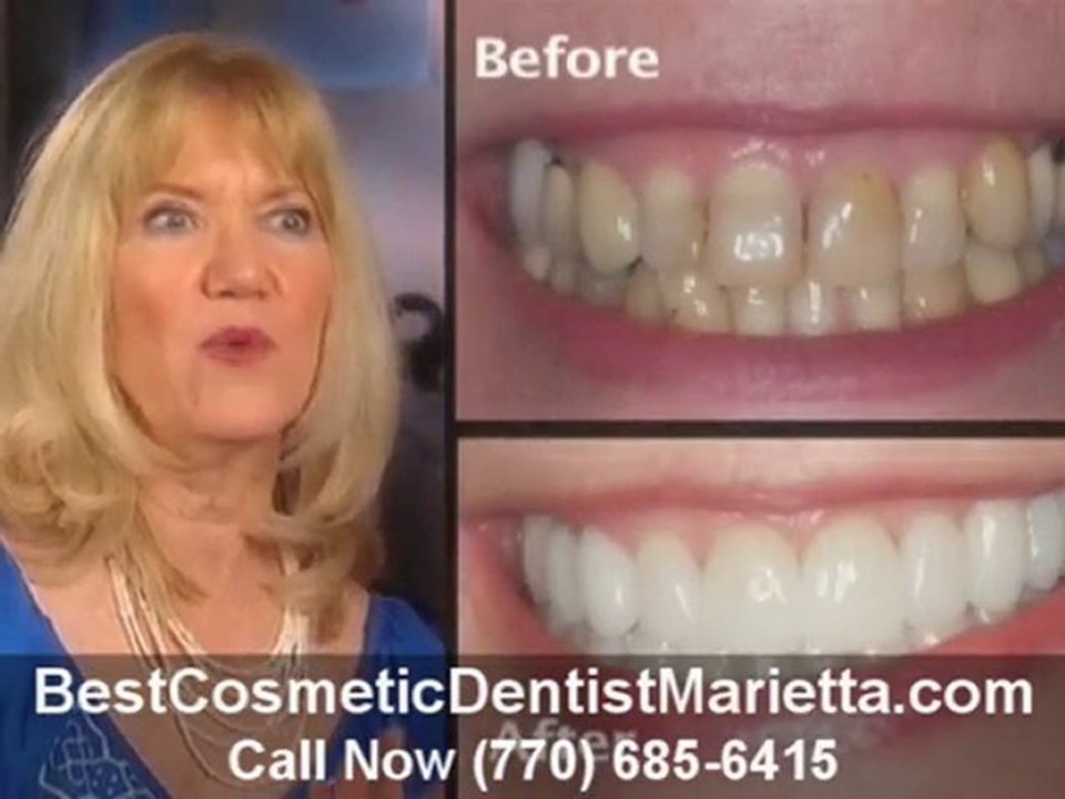 Best Cosmetic Dentist Marietta