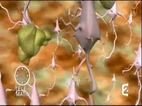 Stress&Sur-poids,Coaching personnel pour maigrir sans régime