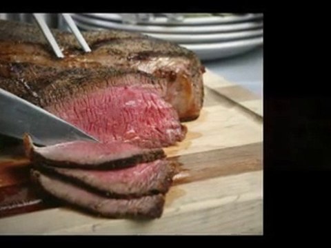 Dental Implants Fairfield CT Dentist Connecticut