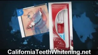 California Teeth Whitening