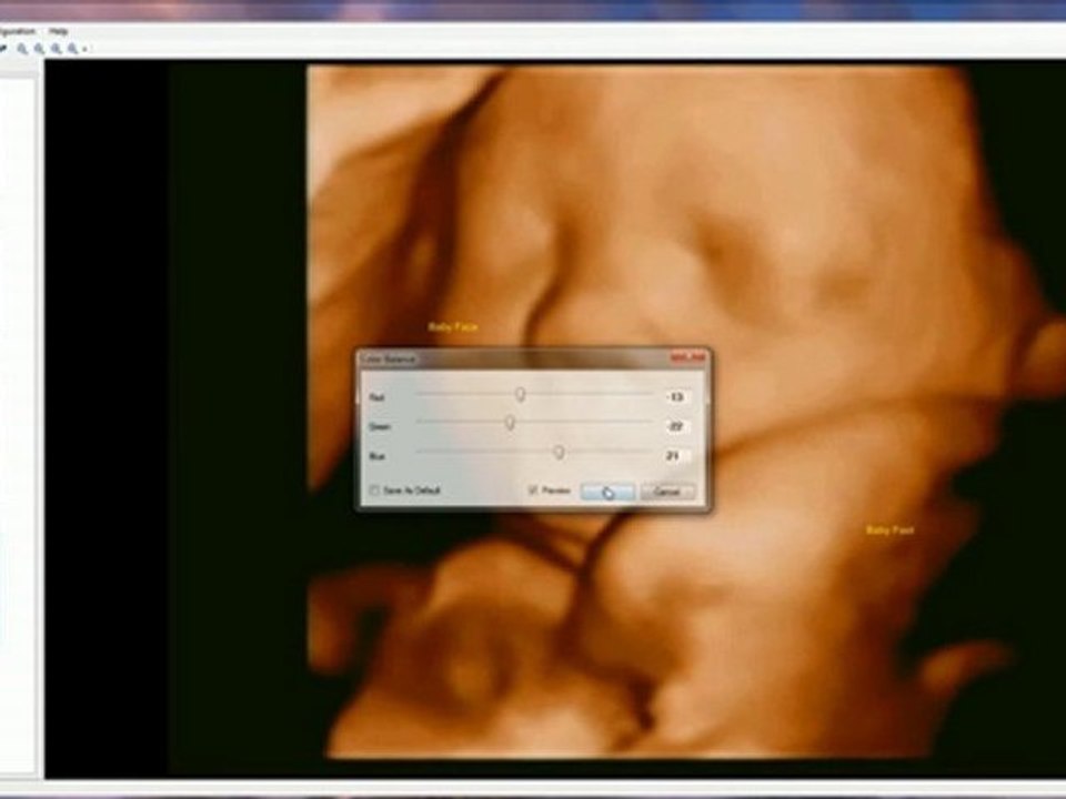 Ultrasound Image Capturing, Printing, Study Management and U