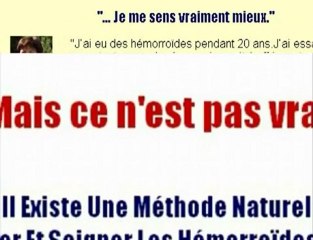 Traitement contre les hémorroïdes: Préventif, non chirurgica