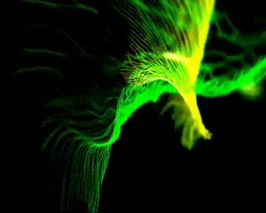 IN FRA RED:"Another Sleepless Night"