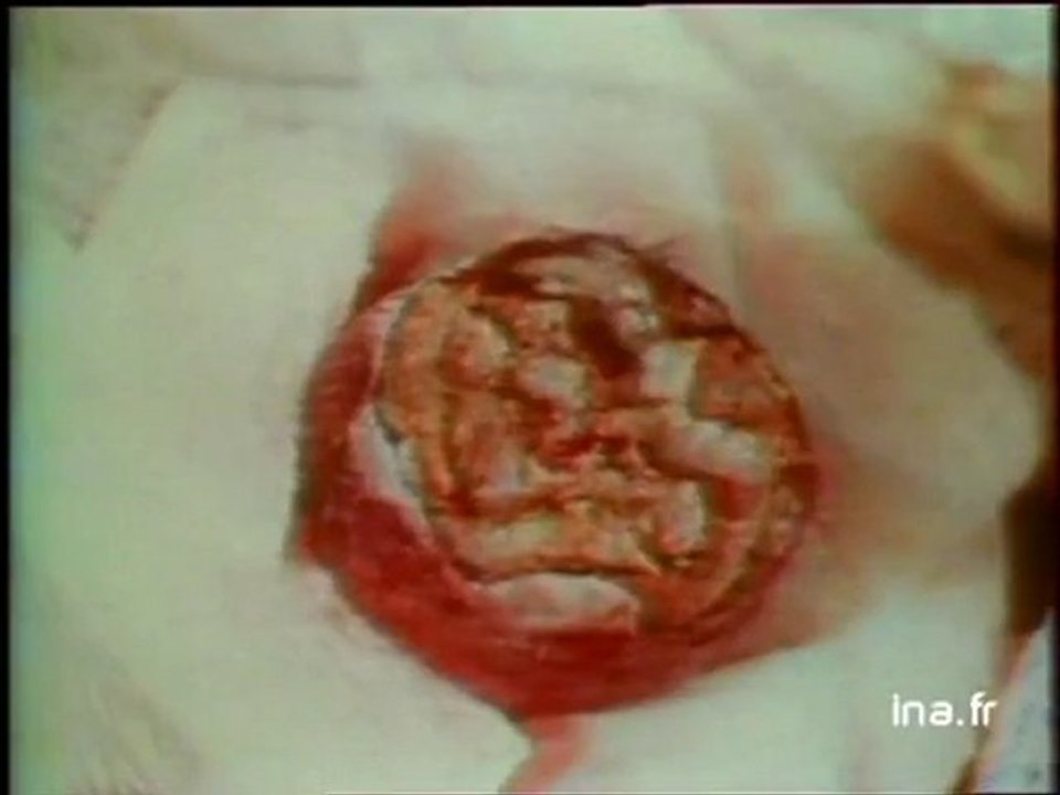 Ja2 20h : émission du 17 mai 1980