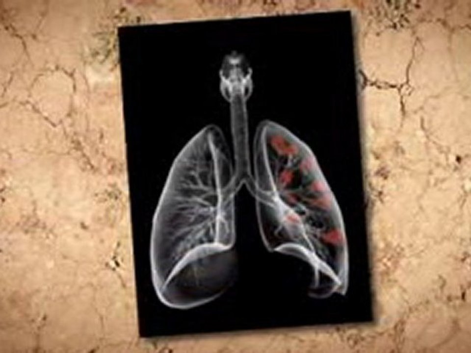 Asbestos Remova in Home Pasadena TX