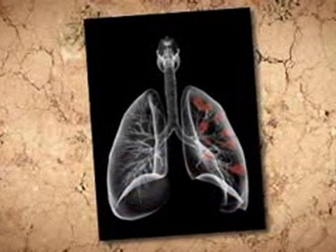 Asbestos Remova in Home Pasadena TX