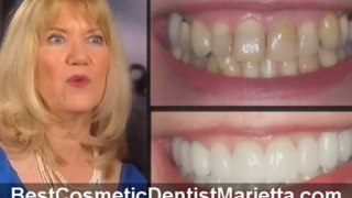 Best Cosmetic Dentist Marietta
