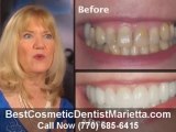 Best Cosmetic Dentist Marietta