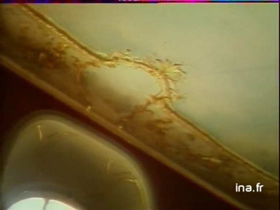 Restauration du château d'Asnières