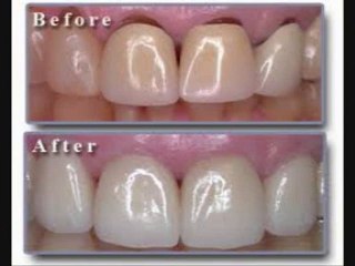 Miami Lakes Florida Dentist Eases Tooth Pain