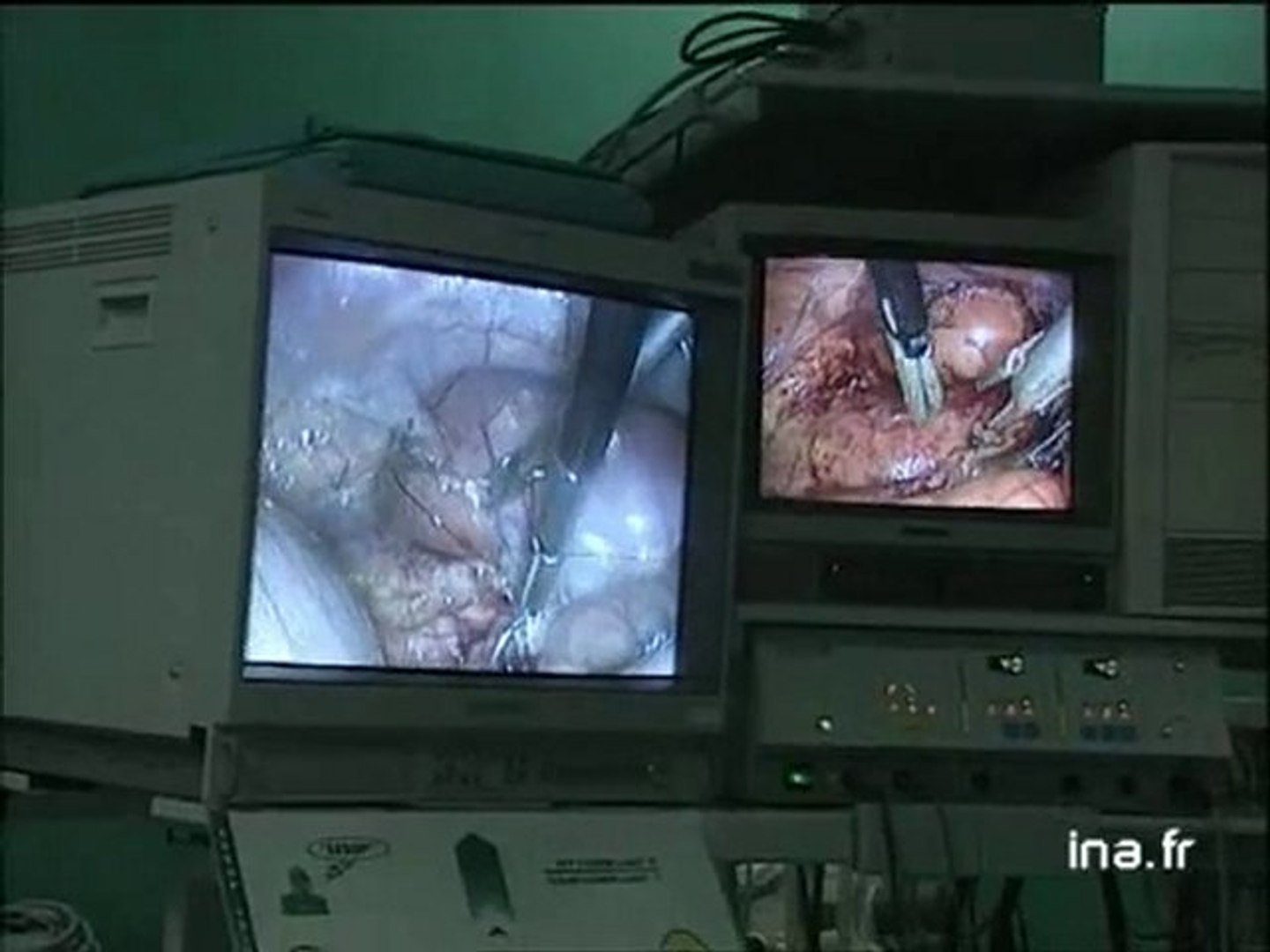 Strasbourg : la première opération assisté par Zeus, le robot chirurgical -  Vidéo Dailymotion