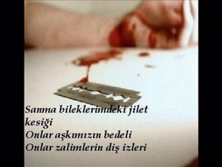 Sanma bileklerimdeki jilet kesiği onlar aşkımızın bedeli:(