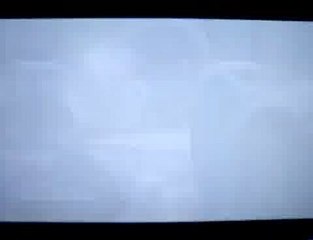 Grey's Anatomy Se7 Ep2 - Shock to the System