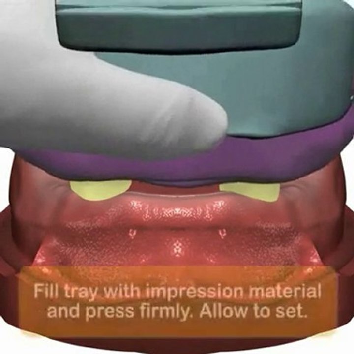 Implant Direct LLC