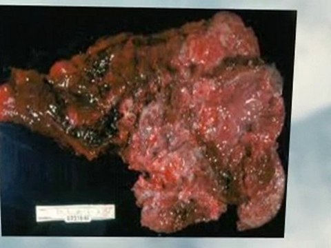 Asbestos Abatement Roswell GA