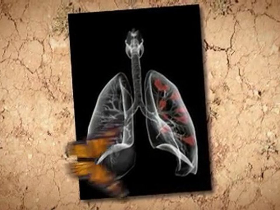 Asbestos Remova  in Home Roswell GA