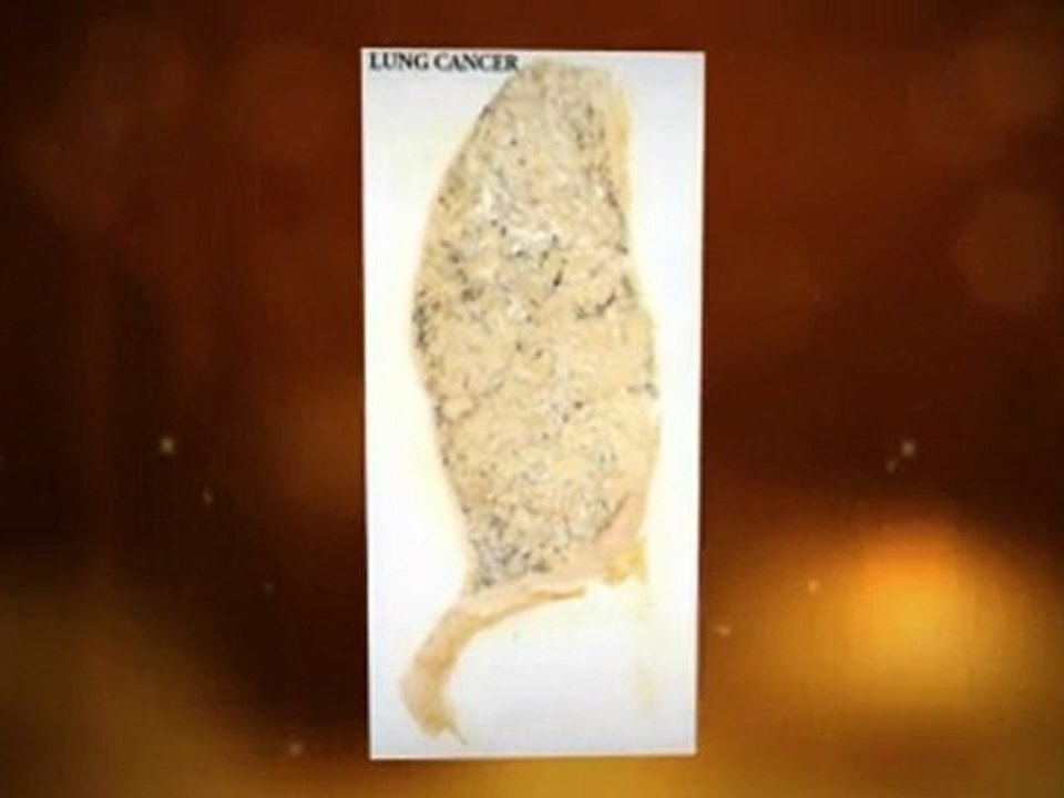 Asbestos Exposure Avondale AZ