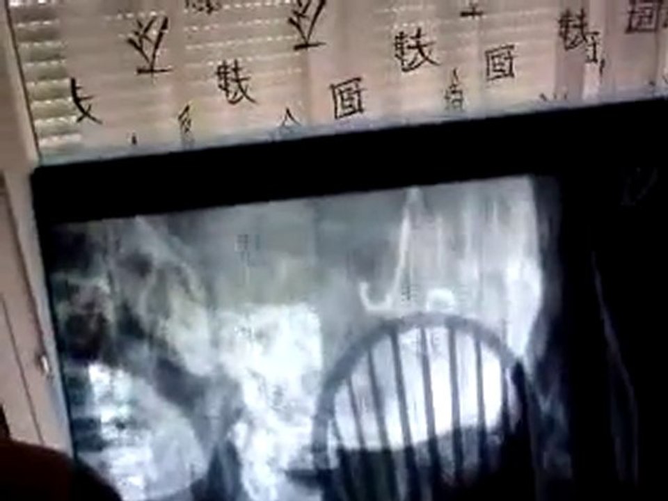 FAYER 88 190 epinal golbey break rue nicolas 21